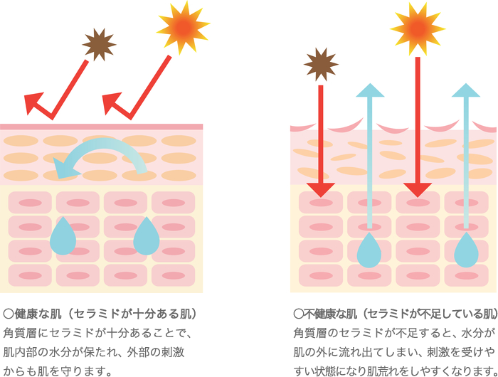 ○健康な肌（セラミドが十分ある肌）○不健康な肌（セラミドが不足している肌）