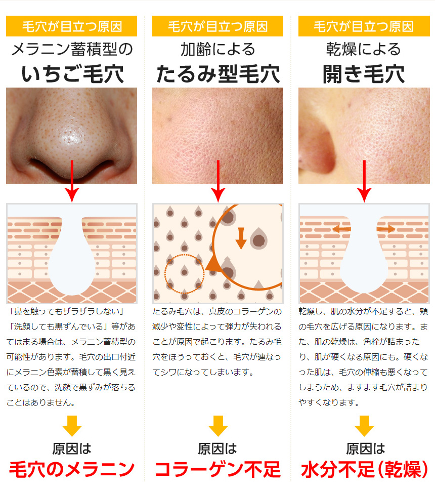 毛穴が目立つ原因とは?