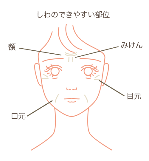 しわのできやすい部位 