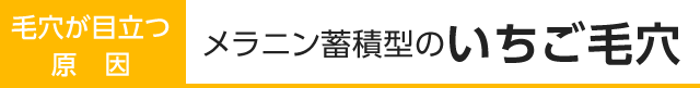 大人の毛穴が目立つ原因1：メラニン蓄積型のいちご毛穴